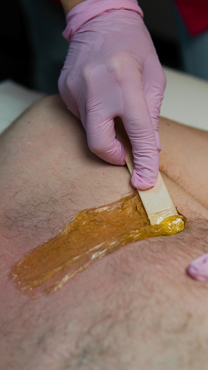 Warm wax applied during a back waxing appointment